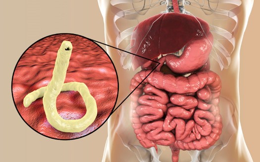 Descubra os sinais de que você pode estar com vermes intestinais