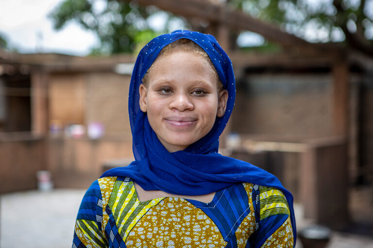 Como é a vida conturbada dos albinos na Somália e suas dificuldades